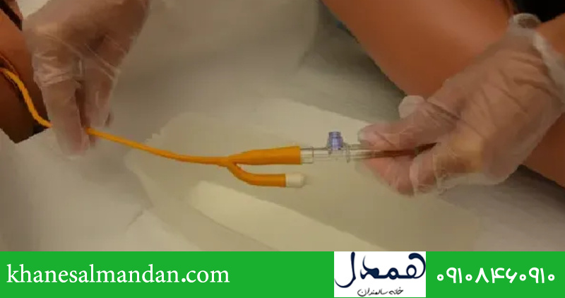 علت نیامدن ادرار بعد از کشیدن سوند 